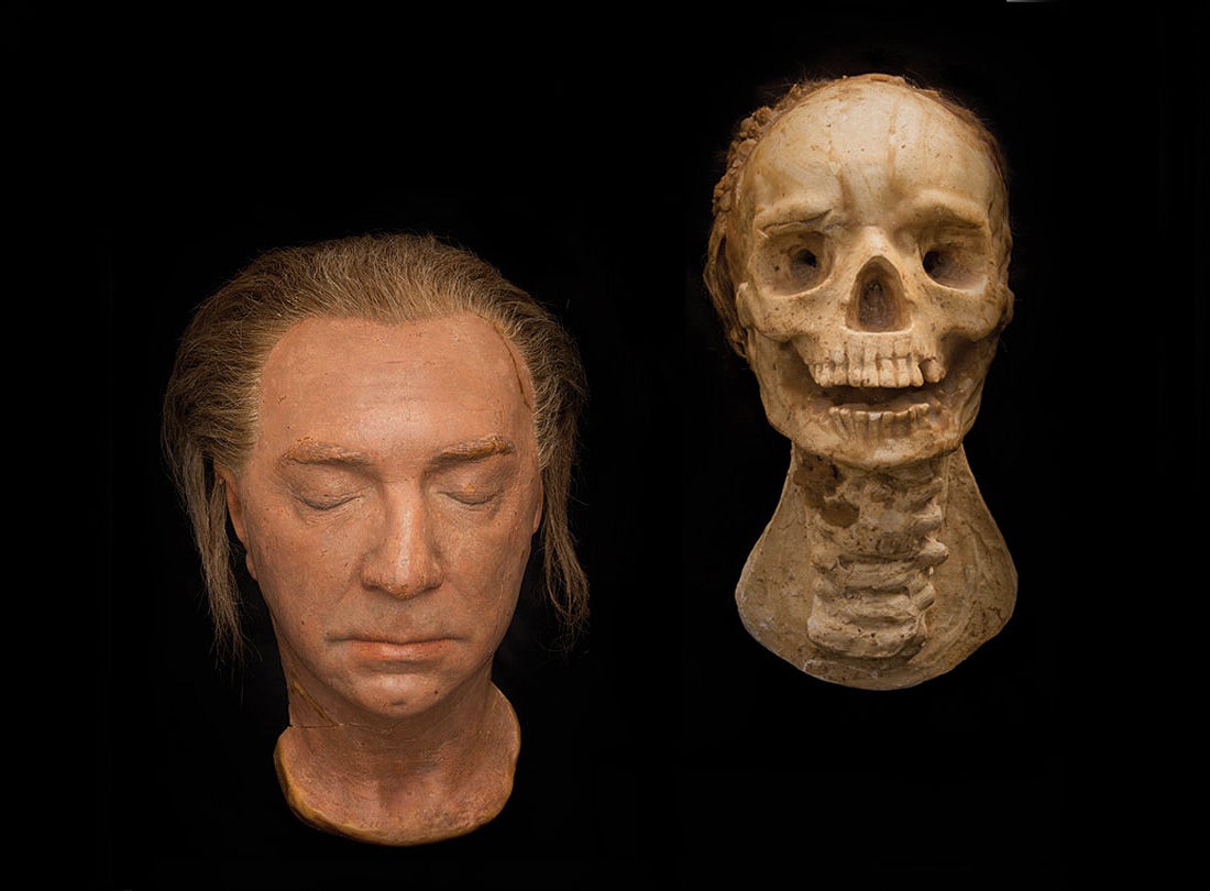 Vampire Armand Tesla’s head before and after it melts in The Return of the Vampire starring Bela Lugosi  1943